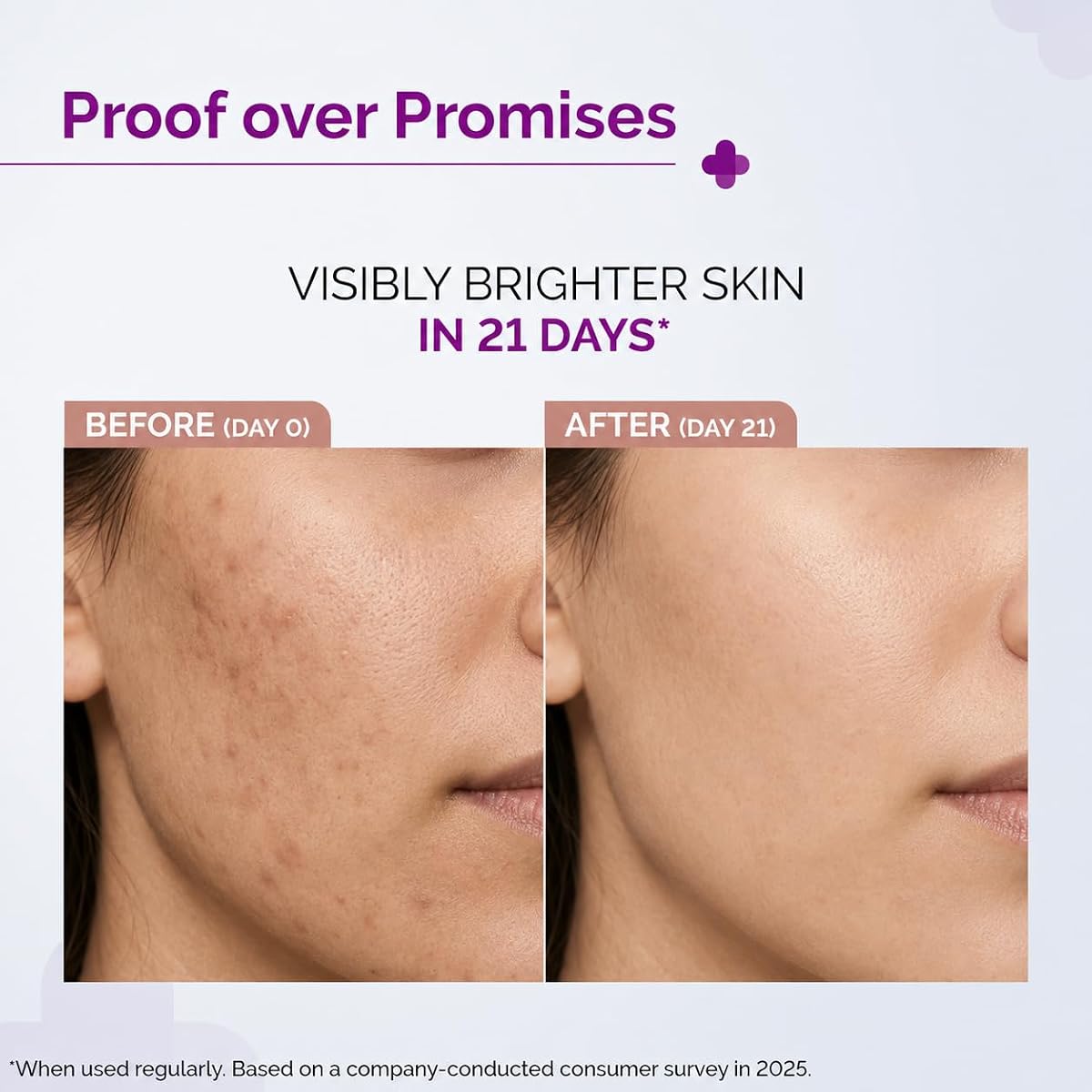The Derma Co Face Serum - 10% Vitamin C with Niacinamide & Hyaluronic Acid, 30ml - Image 3
