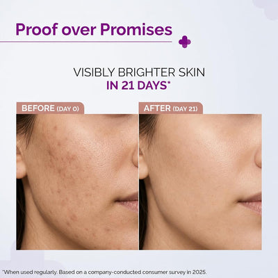 The Derma Co Face Serum - 10% Vitamin C with Niacinamide & Hyaluronic Acid, 30ml - Image 3