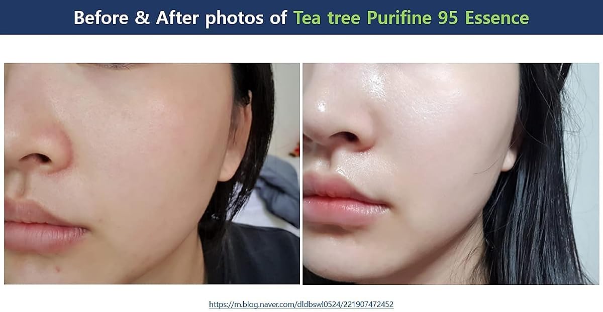 Dr.Ceuracle Tea Tree Purifine Essence, Waterless Formula, 50ml - Image 4