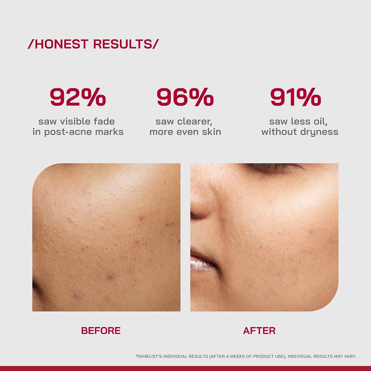 PHD 10 Niacinamide Spot Correcting Serum - 10% Strength, 30ml - Image 4