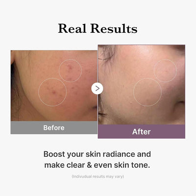 AGE-R Glutathione Glow Toner - Milky 2-Phase, Vegan, 140ml - Image 5