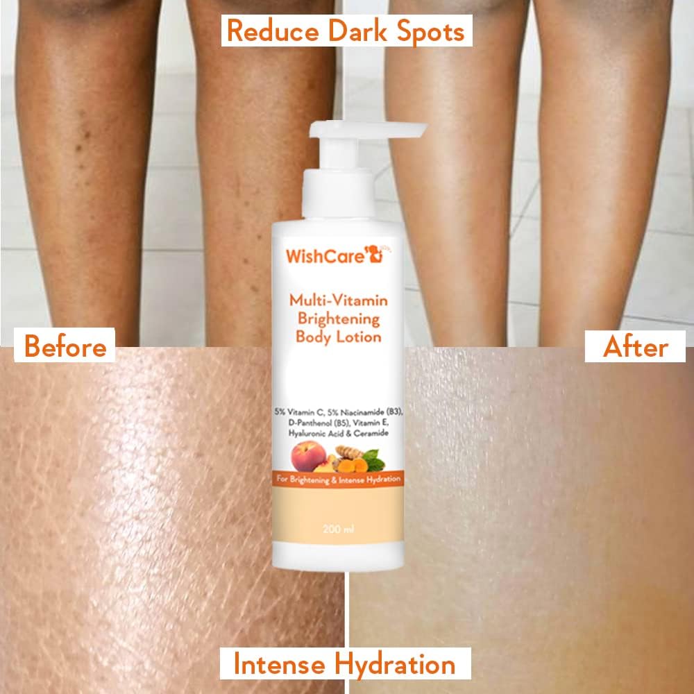 WishCare Multi-Vitamin Brightening Body Lotion - 5% Vitamin C & Niacinamide, 200ml - Image 4