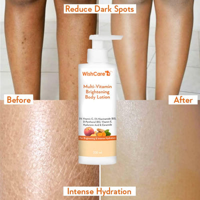 WishCare Multi-Vitamin Brightening Body Lotion - 5% Vitamin C & Niacinamide, 200ml - Image 4