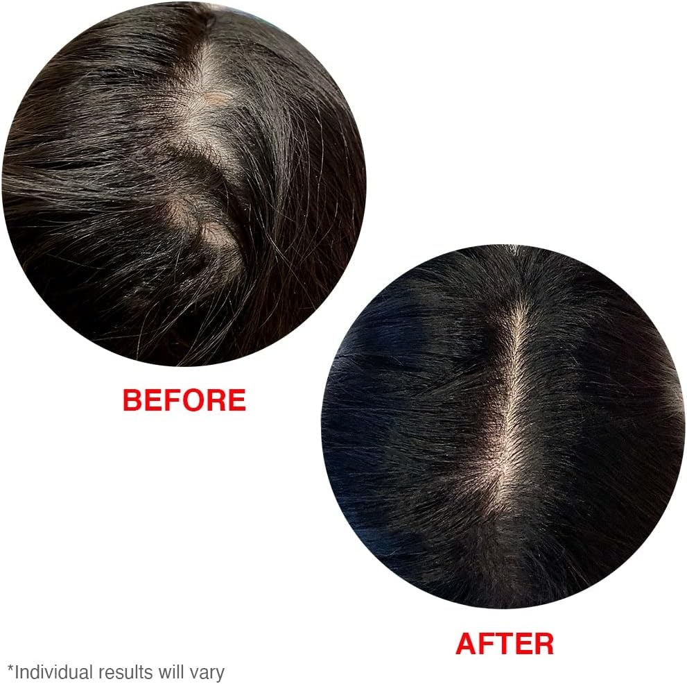 Hairtamin Scalp Serum - Natural Hair Growth Formula, 60ml - Image 4