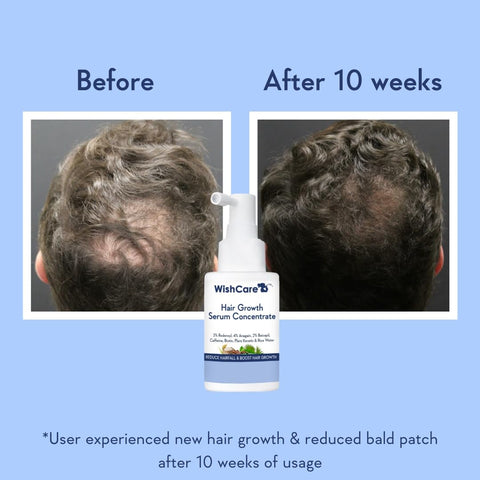 Wishcare Hair Growth Serum Concentrate - Redensyl, Anagain, Caffeine, Biotin, Keratin & Rice Water