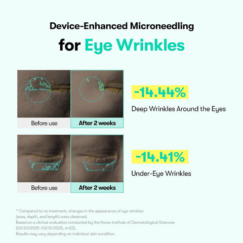 VT PDRN REEDLE SHOT EYE LIFTER 15ml - Eye Contour Cream with Lifting Effect, Microneedles CICA REEDLE and Vegan PDRN - Image 3