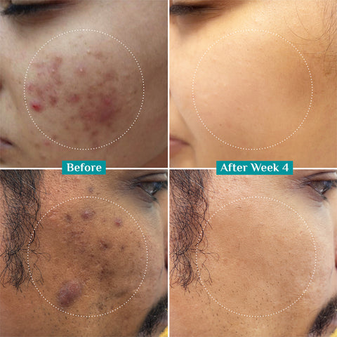 سيروم الوجه بيلغريم ١٠٪ نياسيناميد مع ١٪ زنك PCA - ٣٠ مل