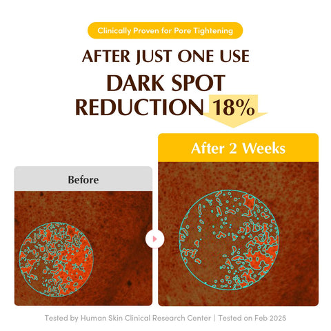 Eqqualberry Collagen Glow Up Hydrogel Mask 30G | 4Sheets