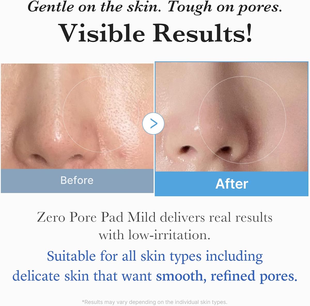 Medicube Zero Pore Pads Mild 2.0 - PHA Exfoliating Toner Pads - 70 Sheets - Image 5