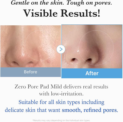 Medicube Zero Pore Pads Mild 2.0 - PHA Exfoliating Toner Pads - 70 Sheets - Image 5