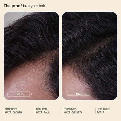Arata Intensive Hair Growth Serum - 3% Redensyl, 3% Procapil, 5% Capixyl - 30ml - Image 3