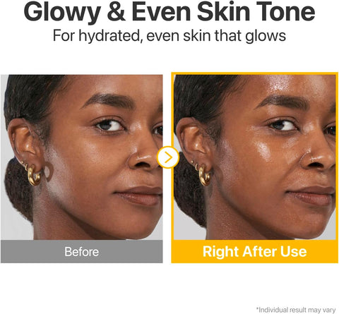 مصل فيتامينات مركز من نومبوزين