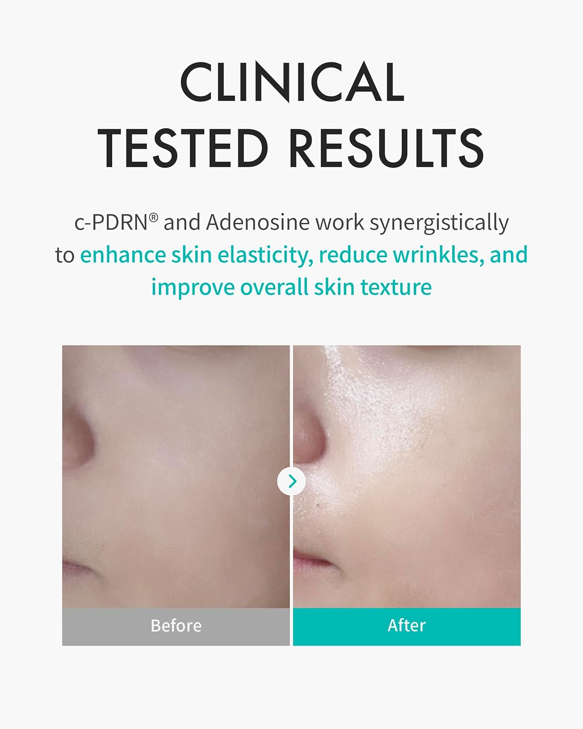Rejuran Turnover Mask - Hydrating Mask Set, 40ml x 5 - Image 3