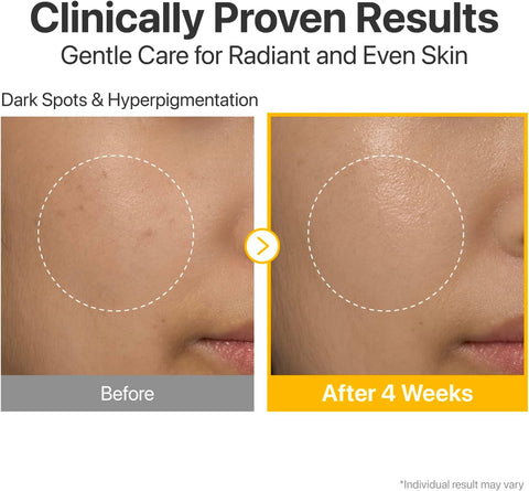 مصل فيتامينات مركز من نومبوزين