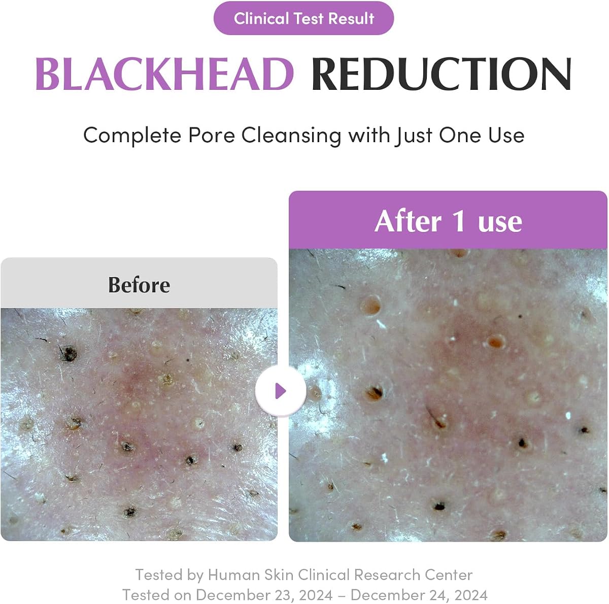 Eqqualberry Purple Rice Pore Purifying Pack Cleanser - Clay and Foam, 130g - Image 5