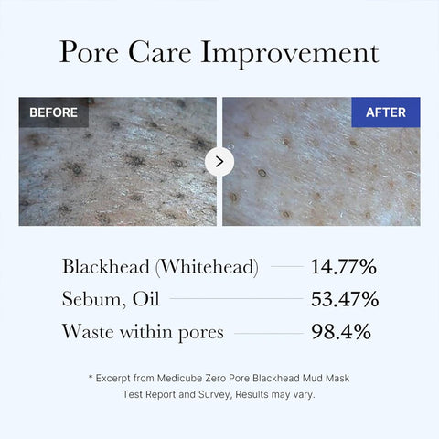 قناع الطين لإزالة الرؤوس السوداء من ميديكوب زيرو بور