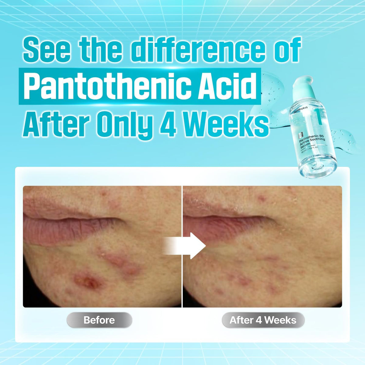 Numbuzin Pantothenic B5 Active Soothing Serum - Face Serum & Treatment, 50ml - Image 4