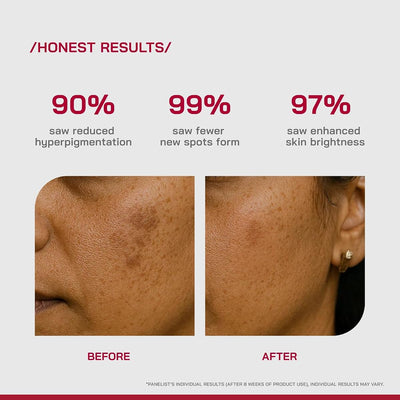 PHD 2 2% Alpha Arbutin Depigmentation Serum - Face Treatment, 30ml - Image 5