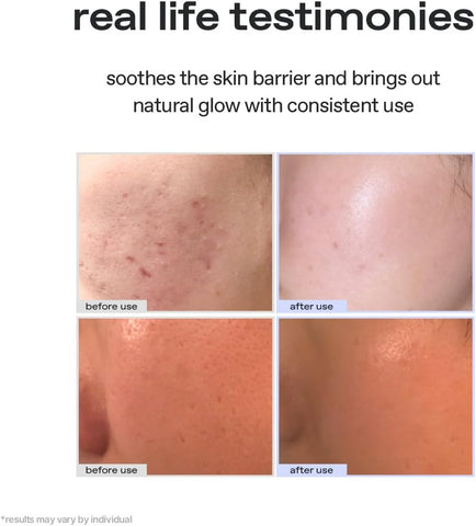 glow aloe barrier support cream, soothing and hydrating face moisturizer with 32.8% aloe vera leaf water, barrier-repair vegan cream for sensitive skin, 50ml - Image 3