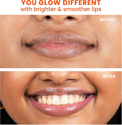 Foxtale Brightening Lip Balm with Vitamin C & Peptides - SPF 30, Light Mauve Glaze, 12g - Image 6