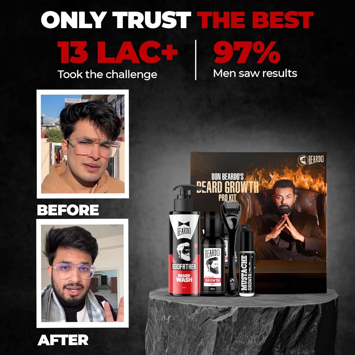 Beardo Beard Growth Pro Kit V3 - Complete Beard Care Set with Beard Oil, Activator & Growth Roll-On - Image 3