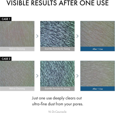 Dr.Ceuracle Pro Balance Night Enzyme Charcoal Wash - 50g - Image 2