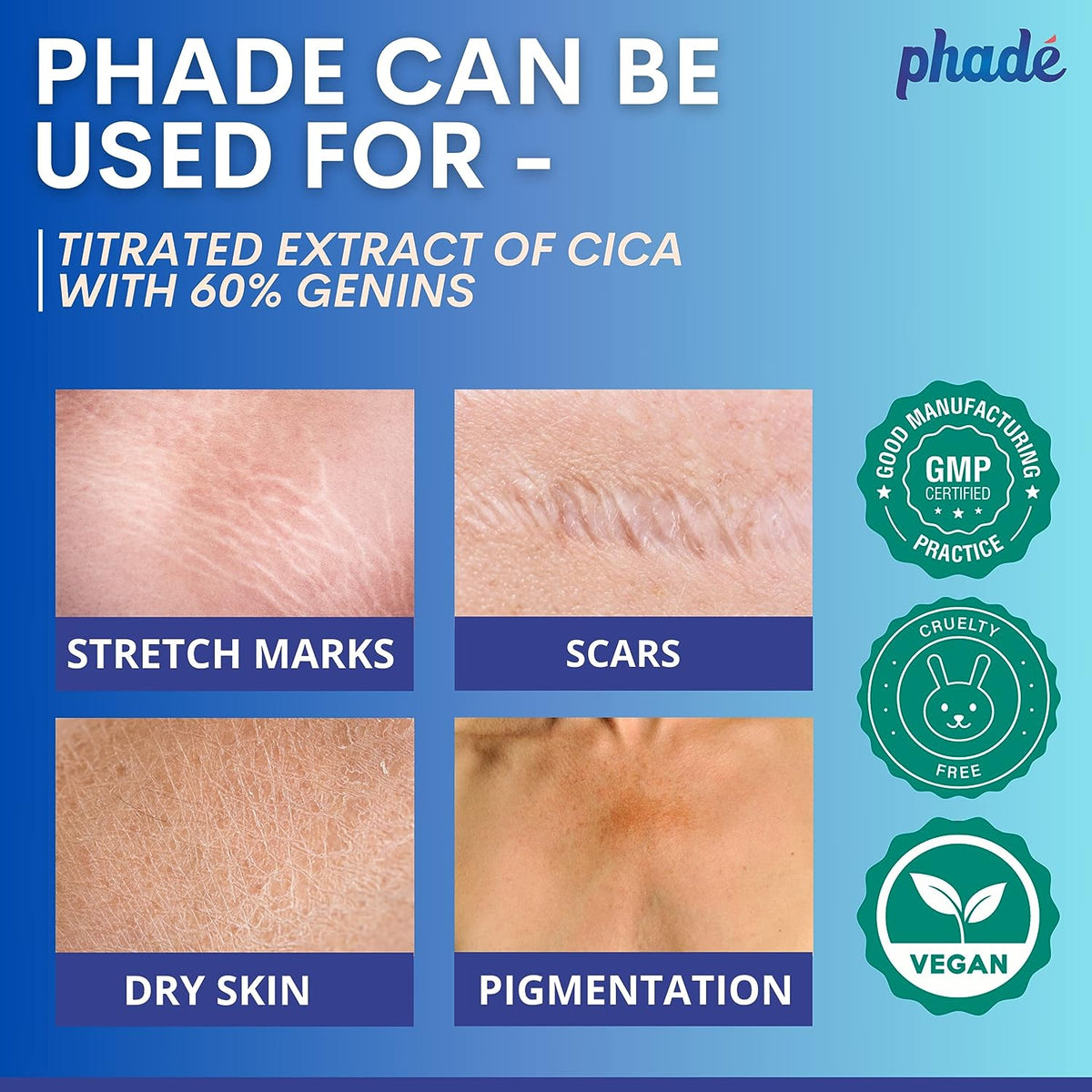 Phade Stretch Mark Cream with Nourishing Formula, 200ml - Image 6