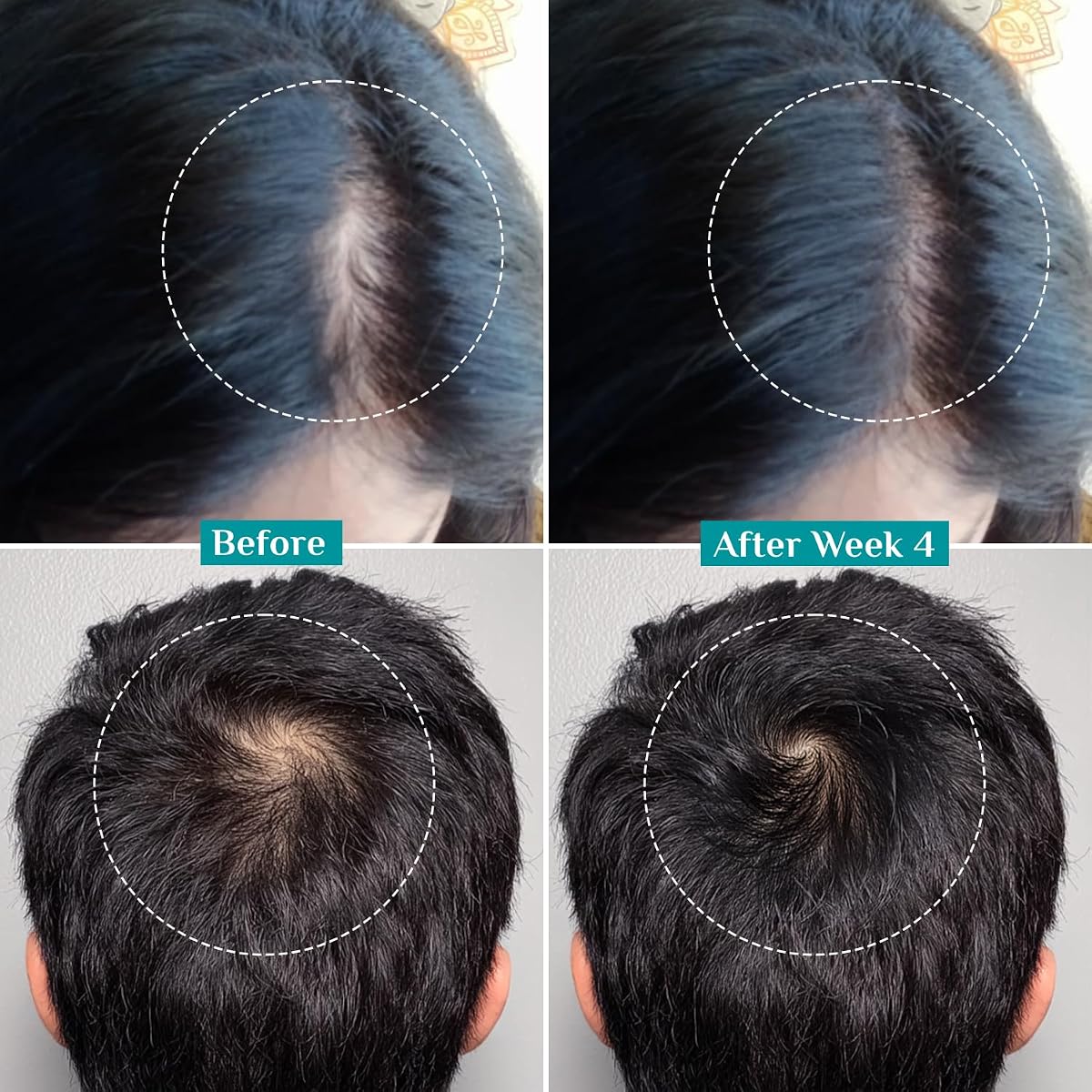 Pilgrim Hair Growth Serum with Redensyl, Anagain, Capilia StemCell - 50ml - Image 5
