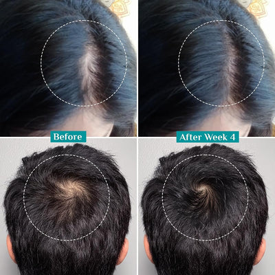 Pilgrim Hair Growth Serum with Redensyl, Anagain, Capilia StemCell - 50ml - Image 5