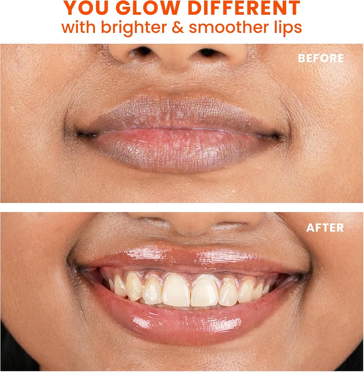 Foxtale SPF 30 Brightening Lip Balm with Peptides & Vitamin C - 12g - Image 5
