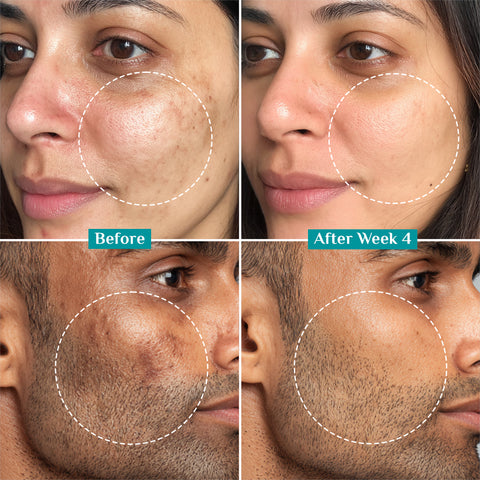 سيروم بيلجريم 15% فيتامين سي للوجه لبشرة متوهجة 20 مل