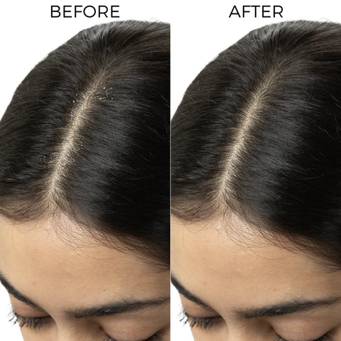 Brillaire Tea Tree Oil 100 Ml