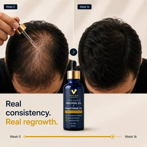 Valeo_Topical_Hair_Solution_seventh_Getkuwa