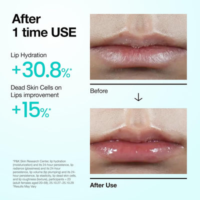 Anua PDRN Lip Serum with Salmon DNA, Hyaluronic Acid & Collagen - 10 ml