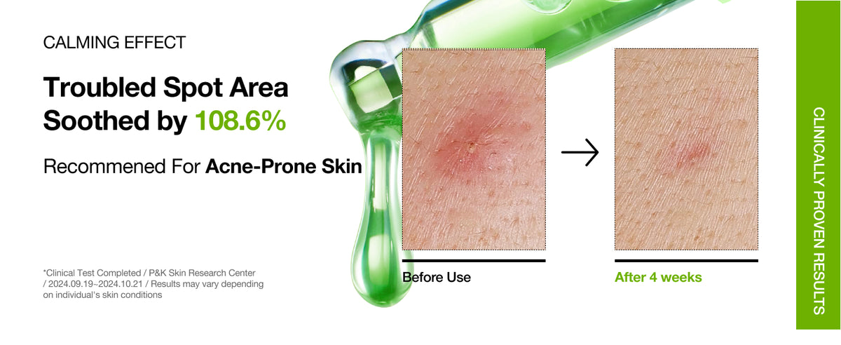 Anua Azelaic Acid 10% Hyaluron Redness Soothing Face Serum, 30ml - 5