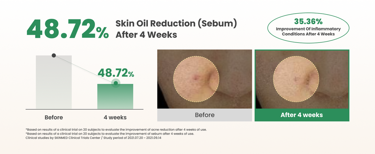 AXIS-Y Spot the Difference Blemish Treatment Serum 15ml - 4-Terpineol & Niacinamide - 8