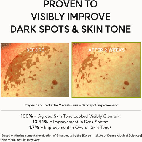 Arencia Vitamin C Booster Shot Serum with Glutathione, Niacinamide and Vitamin E for Dark Spot Care, Fine Lines & Wrinkles, Glass Skin, Korean Skincare 30ml/1.01 fl.oz - Image 7