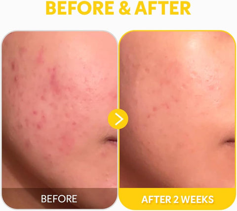 TIRTIR Pure Vitamin C 24% Face Serum – Dark Spot Remover for Sensitive Skin with Collagen Anti Aging Even out Skin Tone Non irritation tested, Wrkinkles, Korean Mild Vita C Facial Serum 1.01 Fl Oz - Image 8