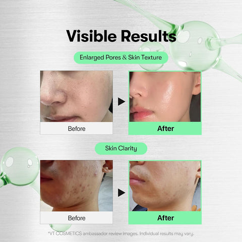 VT COSMETICS CICA Reedle Shot 700 | Spicule Microneedling Serum for Pore Care&Exfoliation, Exosome&Centella Asiatica for Glass Skin, Acne&Blemish Care, Korean Skin Booster (1 Fl Oz / 30ml) - Image 3