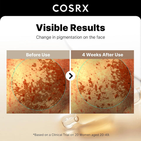 COSRX 2% Alpha Arbutin Discoloration Care Face Serum with Niacinamide, Glutathione & Tranexamic Acid, 1.7 fl oz – Serum for Face, Korean Skin Care - Image 4