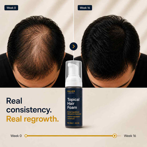 Valeo Hair Growth Pills and Foam Combo