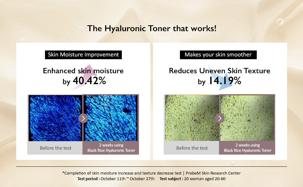 Haruharu Wonder Black Rice Hyaluronic Toner - Alcohol Free, 150ml - 2