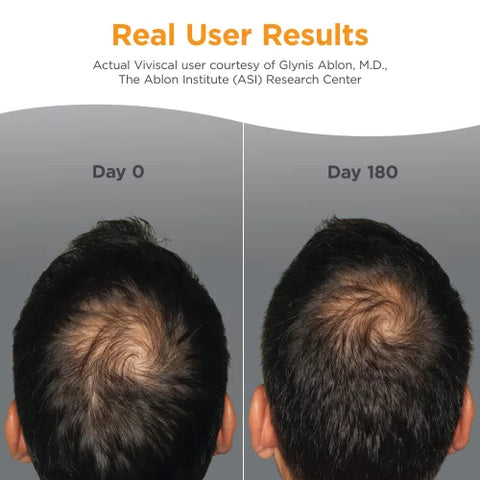 Viviscal Man Advanced Hair Health 60 Tablets