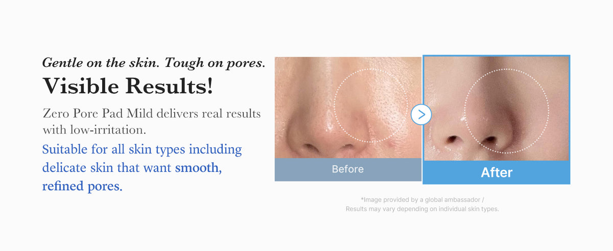 Medicube Zero Pore Pads Mild 2.0 - PHA Exfoliating Toner Pads - 70 Sheets - 4