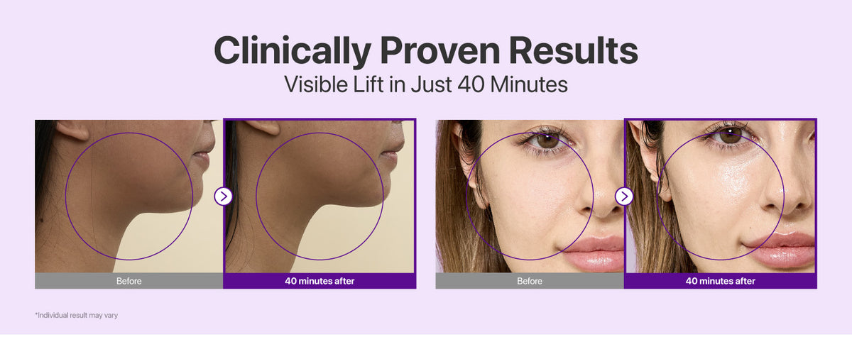 Numbuzin NAD+ BIO Lifting Full Cover Facial Sheet Mask - 4 Sheets + Lifting Band - 7