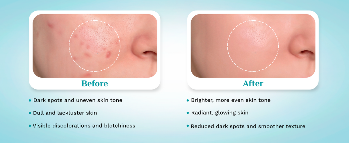Pilgrim Face Serum with 10% Vitamin C for Glowing Skin - 30 ml - 5