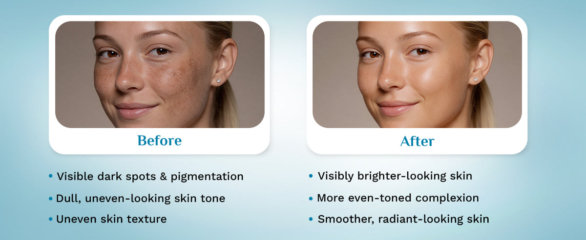Pilgrim Korean Brightening Face Serum with Alpha Arbutin & Vitamin C - 30ml - 5