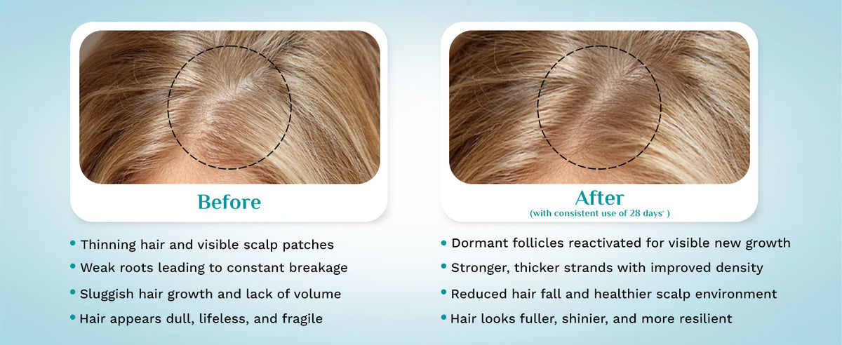 Pilgrim Hair Growth Serum with Redensyl, Anagain, Capilia StemCell - 50ml - 5