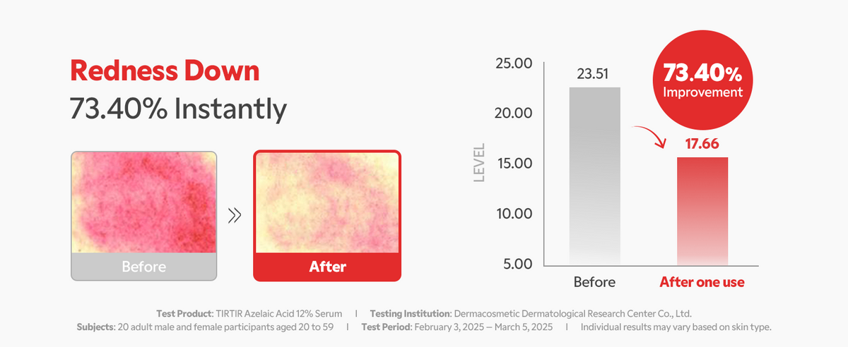 TIRTIR Azelaic Acid Serum 12% - For Blemish-Prone Skin, 30ml - 4