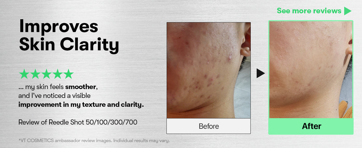 VT Cosmetics CICA Reedle Shot 300 Serum - Microneedling, Centella Asiatica, 50ml - 4